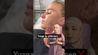 Yuz tortish yaxshimi Ozi skincare skincareroutine uzbekchastrim beauty botox automobile [upl. by Noyk797]