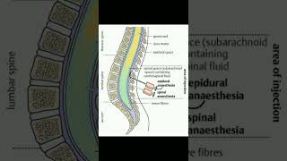 Spinal vs Epidural Anesthesia 💉👩‍⚕️doctor medical shorts anesthesia hospital doclife medico [upl. by Amersham]