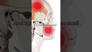 Temporalis Muscle Trigger Points [upl. by Hildegarde]