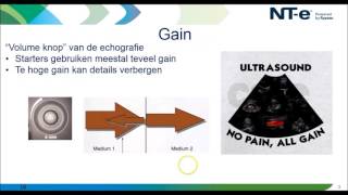 Webinar knoppologie knobology in de echografie [upl. by Yeaton]