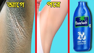 নিশ্চিত বগলের কালো দাগ দূর হবেই  Dark Underarms ফর্সা করুন  bogoler kalo dag dur korar upay [upl. by Gibbs]