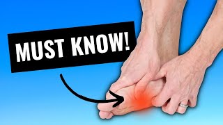 Plantar Fasciitis 4 Things You Must Do To Stop The Pain [upl. by Tingey]