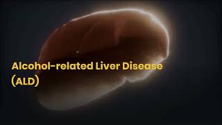 Enlarged Liver Treatment  Causes [upl. by Bettye]