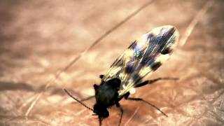 Midge bites through presenters arm  The Secret Life of Midges  BBC One [upl. by Frankel]