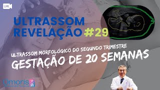 ULTRASSOM MORFOLÓGICO ao vivo Como é feito  Gravidez 20 semanas  Revelação sexo do bebê 29 [upl. by Maressa]