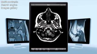 eAnatomy IMAIOS on iPad [upl. by Ecarret378]