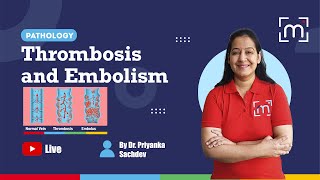 Thrombosis and Embolism with Dr Priyanka Sachdev [upl. by Sirromal]