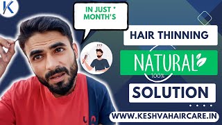 Control quot Hair Thinningquot In 2 Months ✅ All Naturally 🔥 keshvahaircare [upl. by Aietal489]