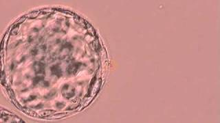 Human Blastocyst Artificial Collapse with Laser Fertility Specialists of Texasavi [upl. by Aerdnaeel]