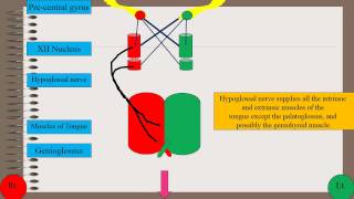 Tongue deviation in hypoglossal palsy [upl. by Gruber]