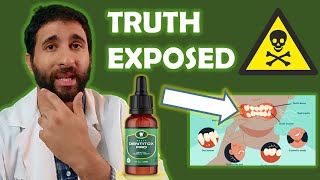 Dentitox Pro Reviews  🔴 My Honest Dentitox Pro Supplement Review 2022 🔴  Dentitox Pro Review [upl. by Mace]