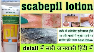 Scabepil lotion  permethrin lotion  useapply methodside effects पूरी जानकारी हिंदी में । [upl. by Utter127]