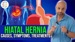 Understanding Hiatal Hernia causes symptoms diagnostic tests treatments [upl. by Nissy713]