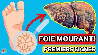 LE FOIE est en train de MOURIR 15 Signes étranges de DOMMAGES AU FOIE [upl. by Aelahc]