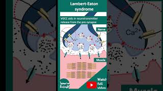 LambertEaton syndrome  proximal muscle weakness  1 minute pathology  USMLE [upl. by Sissel937]