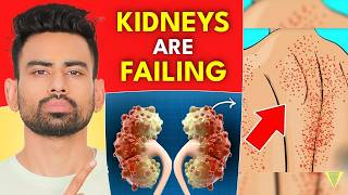 6 Early Warning Signs of Kidney Disease [upl. by Treulich443]