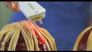 How the HairMax LaserComb works Stop Hair Loss now [upl. by Nnitsuj]