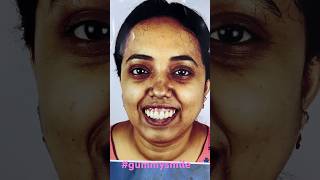 Best Maxillofacial Surgery in India [upl. by Ahseat979]