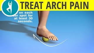 Arch Foot Pain  Problems with Plantar Fasciitis [upl. by Leachim]