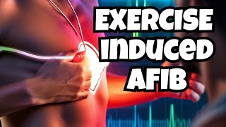 Exercise Induced AFib Expert Tips [upl. by Carri902]