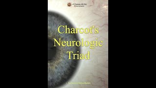 Multiple Sclerosis Charcots Neurologic Triad [upl. by Thacker]