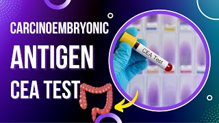 Carcinoembryonic Antigen Test  CEA Blood Test  Tumor Marker [upl. by Ylhsa]