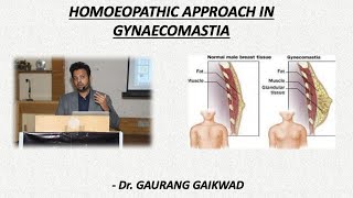 Homoeopathic Approach in Gynaecomastia  Dr Gaurang Gaikwad [upl. by Aineval]