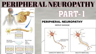 PERIPHERAL NEUROPATHY  PART1  WALLERIAN DISTAL AXONAL DEGENERATION amp SEGMENTAL DEMYELINATION [upl. by Aeniah]