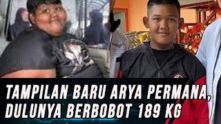 Tampilan Baru Arya Permana Bocah Obesitas Asal Karawang Dulu Berbobot 1895 Kg [upl. by Kcirded812]