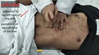 Abdominal examination 2 liver examination [upl. by Quartus]