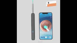 Ear Cleaner Otoscope Ear Wax Removal Tool With Camera LED Light Wireless Ear Endoscope Ear Clean [upl. by Kaazi]