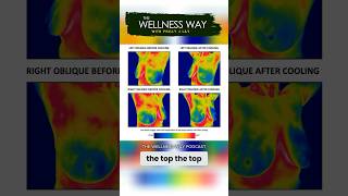 The results of my thermogram thermography breastcancerawareness [upl. by Asnarepse]