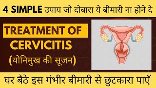 सर्विसाइटिस Cervicitis के घरेलू इलाज । CERVICITIS CURE । Treatment of Cervicitis [upl. by Newby783]