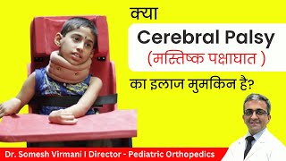 ✅ Cerebral Palsy क्या है I क्या Cerebral Palsy का इलाज हो सकता है I Dr Somesh Virmani [upl. by Eiramlirpa]