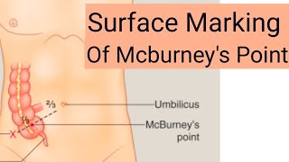 Surface Marking of Mcburneys Point  Anatomy of Mcburneys Point [upl. by Nerraw]