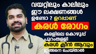 കരളിലെ കൊഴുപ്പ് പുറംതള്ളി കരൾ ക്ലീൻ ആവും ഇങ്ങനെ ചെയ്താൽ  Fatty Liver and Liver Disease Malayalam [upl. by Wight]