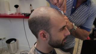 Hair Replacement for Men at The Hair Clinic Montreal featuring The Non Surgical Hair Transplant [upl. by Amye]