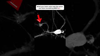 Brain cell restructures itself after forming a new connection neuroplasticity neuroscience brain [upl. by Geerts]