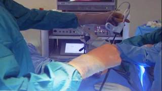 Laparoscopic Hysterectomy [upl. by Falito]