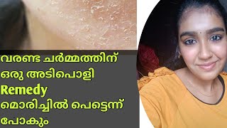 വരണ്ട ചർമം അകറ്റാൻ Get Rid Of Dry Skin Naturally At HomeMalayalam [upl. by Siraf739]