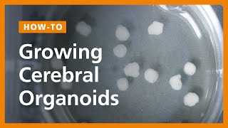 How to Grow Cerebral Organoids from Human Pluripotent Stem Cells [upl. by Gentilis422]