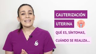 ¿Qué es la cauterización del cuello del útero y cuándo se realiza [upl. by Ardin]