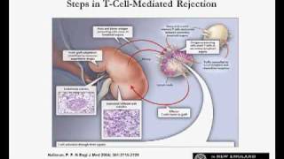 Immunosuppressive Drugs for Kidney Transplantation [upl. by Fransisco]