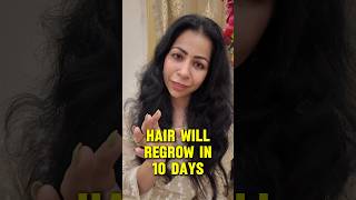 Stop Hair Fall amp Regrow Hair in 10 Days In Monsoon  Suman Pahuja  Shorts haircare hair [upl. by Stricklan136]