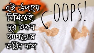 এই সহজ উপায়ে দূর করুন কাপড়ের কঠিন দাগ  how to remove clothes stain  kapore dag tolar upay [upl. by Dianne]