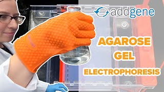 Agarose Gel Electrophoresis [upl. by Eixela]