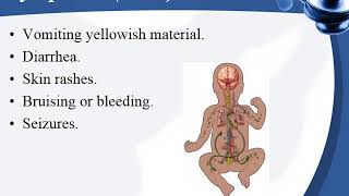 Neonatal sepsis [upl. by Farrell]