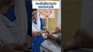 instant relief agnikarma heelpaintreatment ytshorts shortsfeed [upl. by Vania]