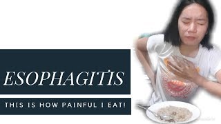 Esophagitis This is how painful I EAT [upl. by Scever730]