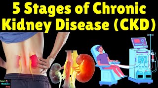 5 Stages of Chronic Kidney Disease CKD  Stages of Chronic Kidney Disease CKD Stages Explained [upl. by Mandeville]